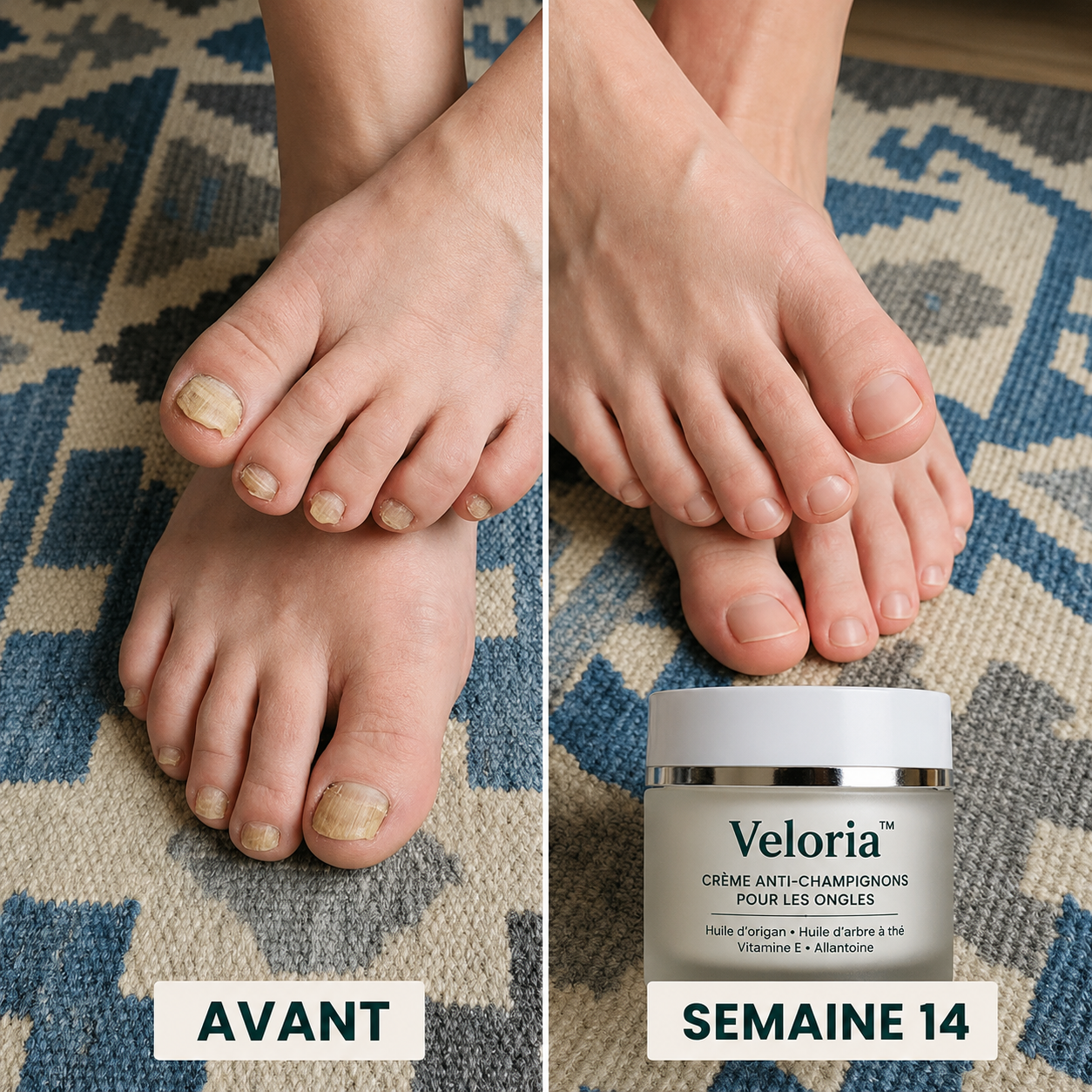 Veloria™